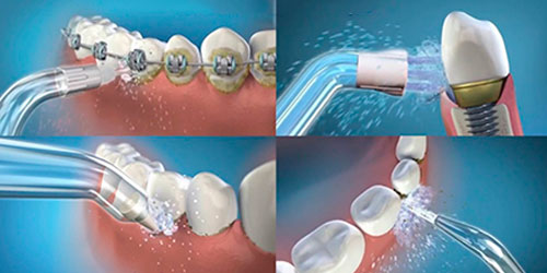 HidroShine™ - Irrigador Bucal